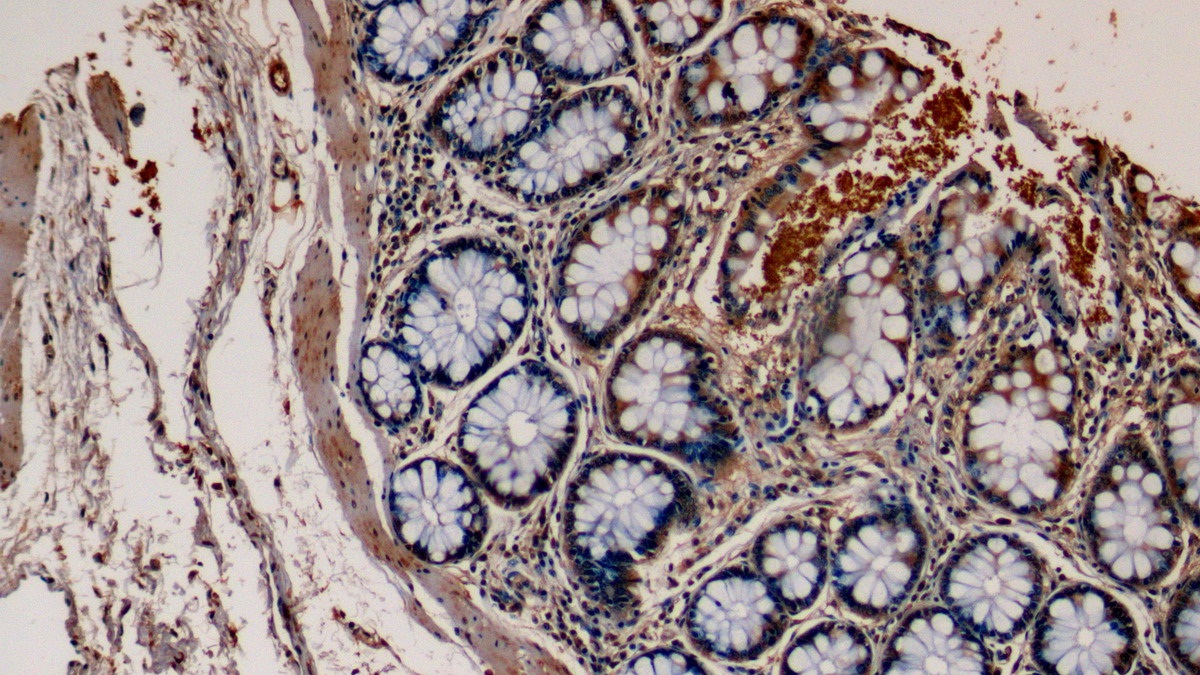 Monoclonal Antibody to Protein Kinase C Epsilon (PKCe)