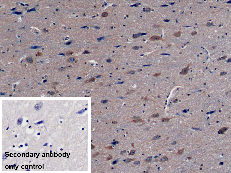 Monoclonal Antibody to Protein Kinase C Epsilon (PKCe)