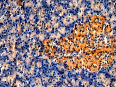 Monoclonal Antibody to Protein Kinase C Epsilon (PKCe)