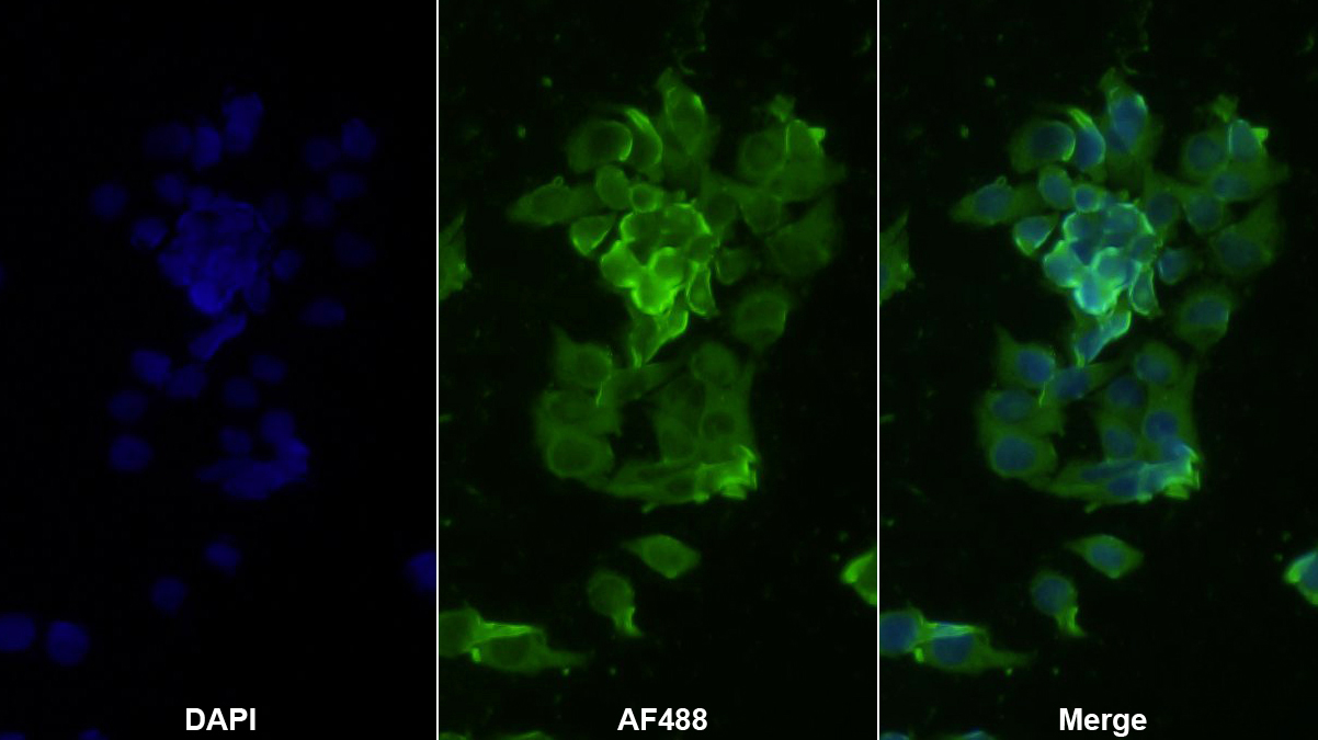 Monoclonal Antibody to Insulin (INS)