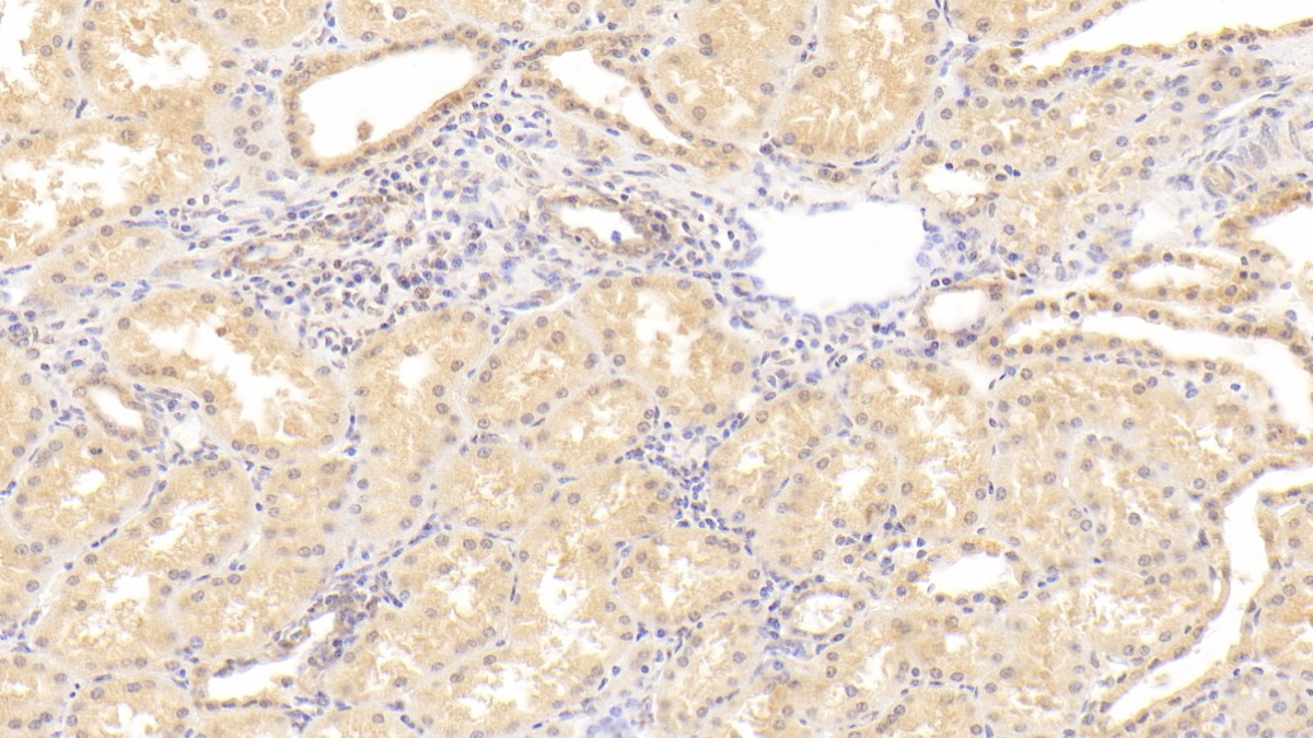 Monoclonal Antibody to Cluster Of Differentiation 55 (CD55)