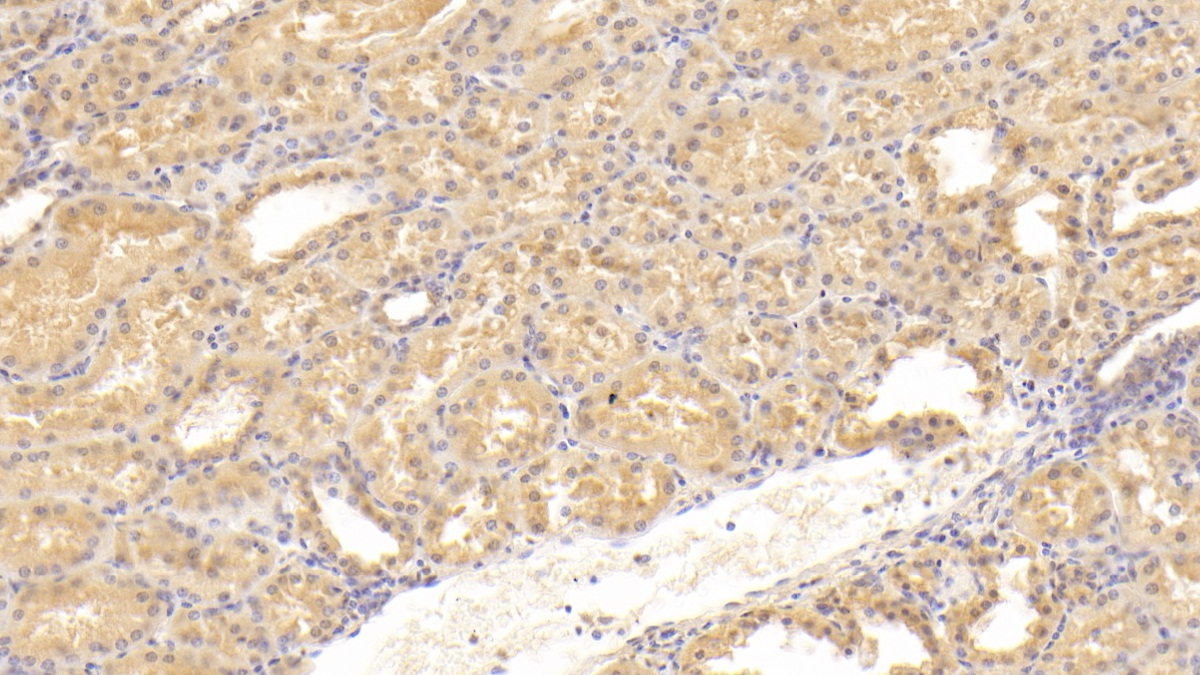 Monoclonal Antibody to Cluster Of Differentiation 55 (CD55)