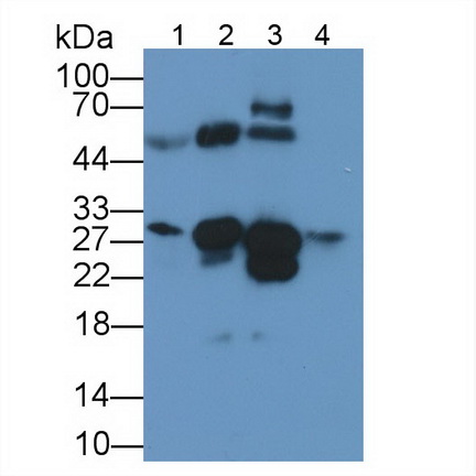 Monoclonal Antibody to Cardiac Troponin I (cTnI)