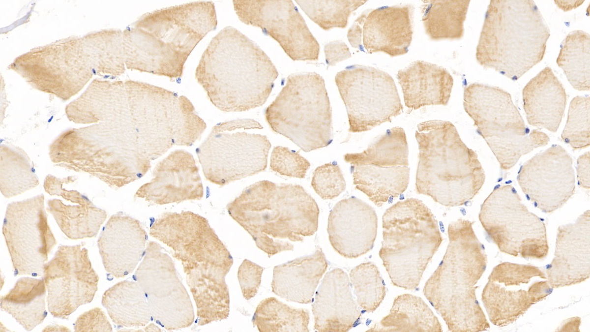 Monoclonal Antibody to Cardiac Troponin I (cTnI)