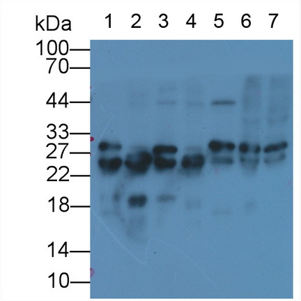 Monoclonal Antibody to Cardiac Troponin I (cTnI)