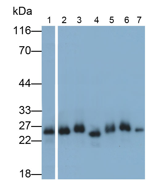 Monoclonal Antibody to Cardiac Troponin I (cTnI)