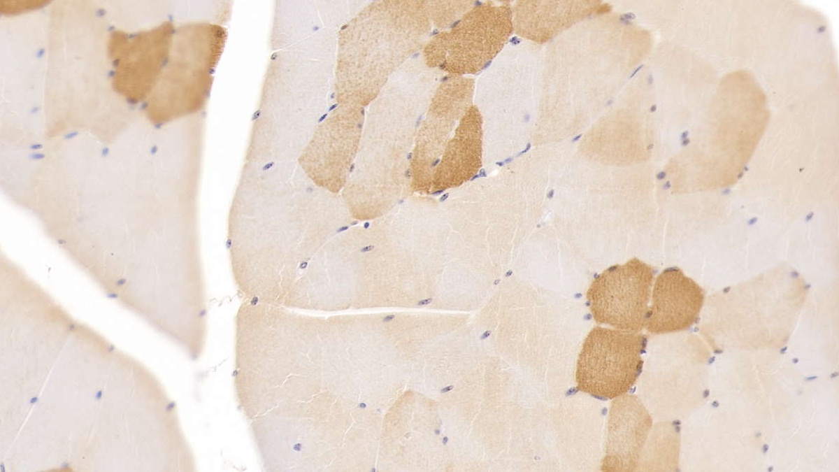 Monoclonal Antibody to Myoglobin (MYO)