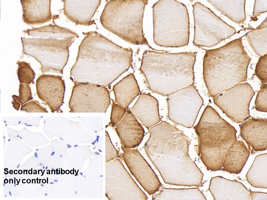 Monoclonal Antibody to Myoglobin (MYO)