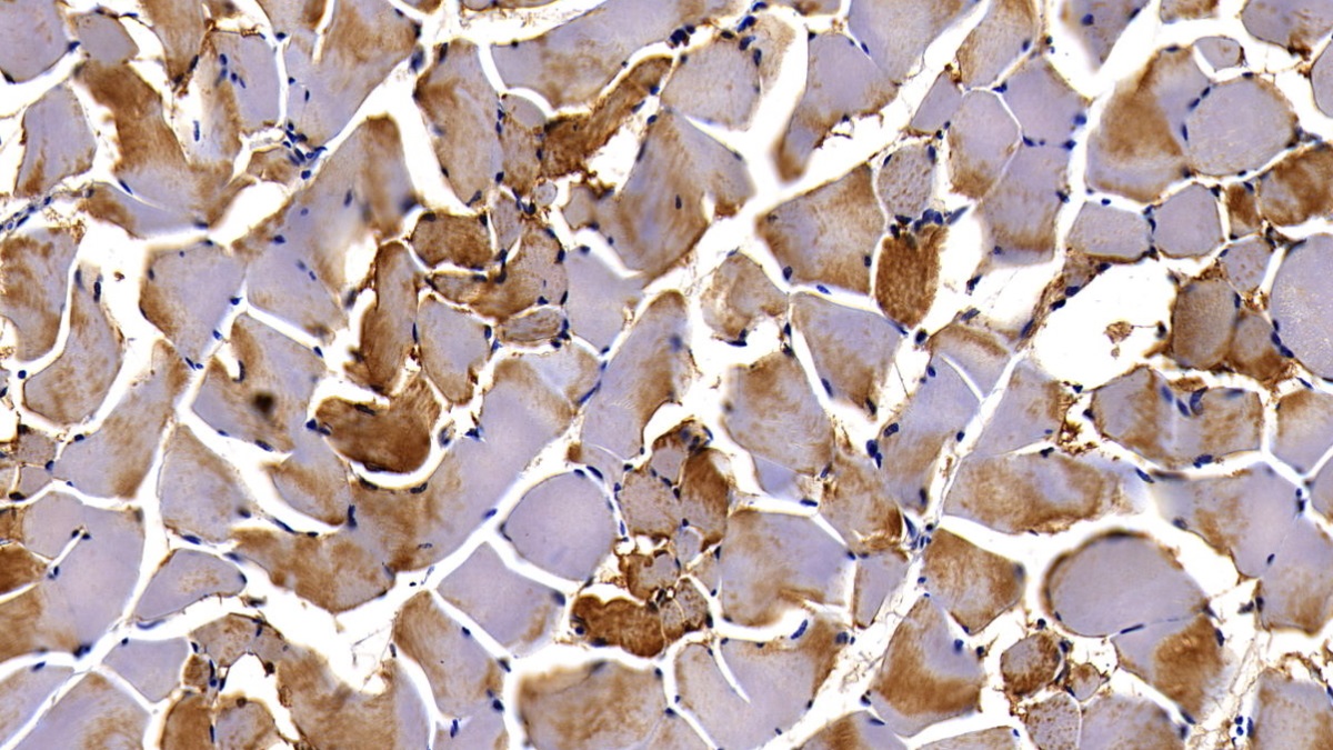 Monoclonal Antibody to Myoglobin (MYO)