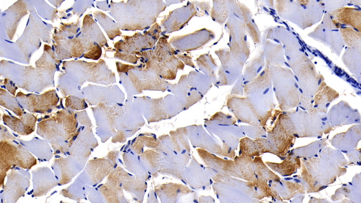 Monoclonal Antibody to Myoglobin (MYO)