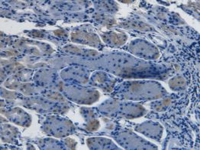 Monoclonal Antibody to Endothelin 1 (EDN1)