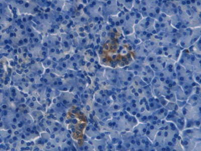 Monoclonal Antibody to Endothelin 1 (EDN1)
