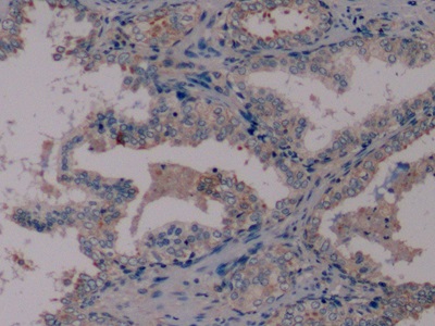 Monoclonal Antibody to Nestin (NES)