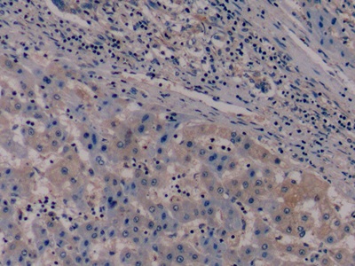 Monoclonal Antibody to Nestin (NES)