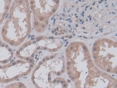 Monoclonal Antibody to Nestin (NES)