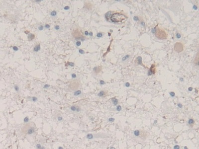 Monoclonal Antibody to Nestin (NES)