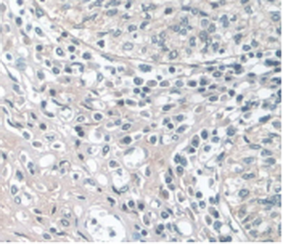 Monoclonal Antibody to Apolipoprotein A1 (APOA1)