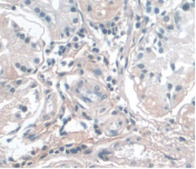 Monoclonal Antibody to Apolipoprotein A1 (APOA1)