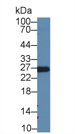 Monoclonal Antibody to Apolipoprotein A1 (APOA1)