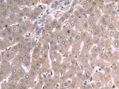 Monoclonal Antibody to Apolipoprotein A1 (APOA1)