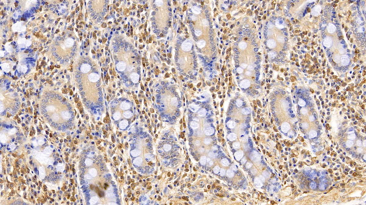 Monoclonal Antibody to Apolipoprotein A1 (APOA1)