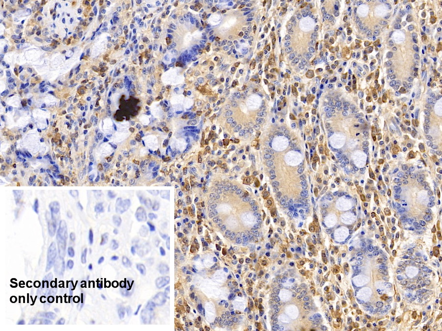 Monoclonal Antibody to Apolipoprotein A1 (APOA1)