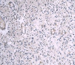 Monoclonal Antibody to Apolipoprotein A1 (APOA1)