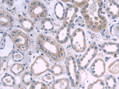 Monoclonal Antibody to Apolipoprotein A1 (APOA1)