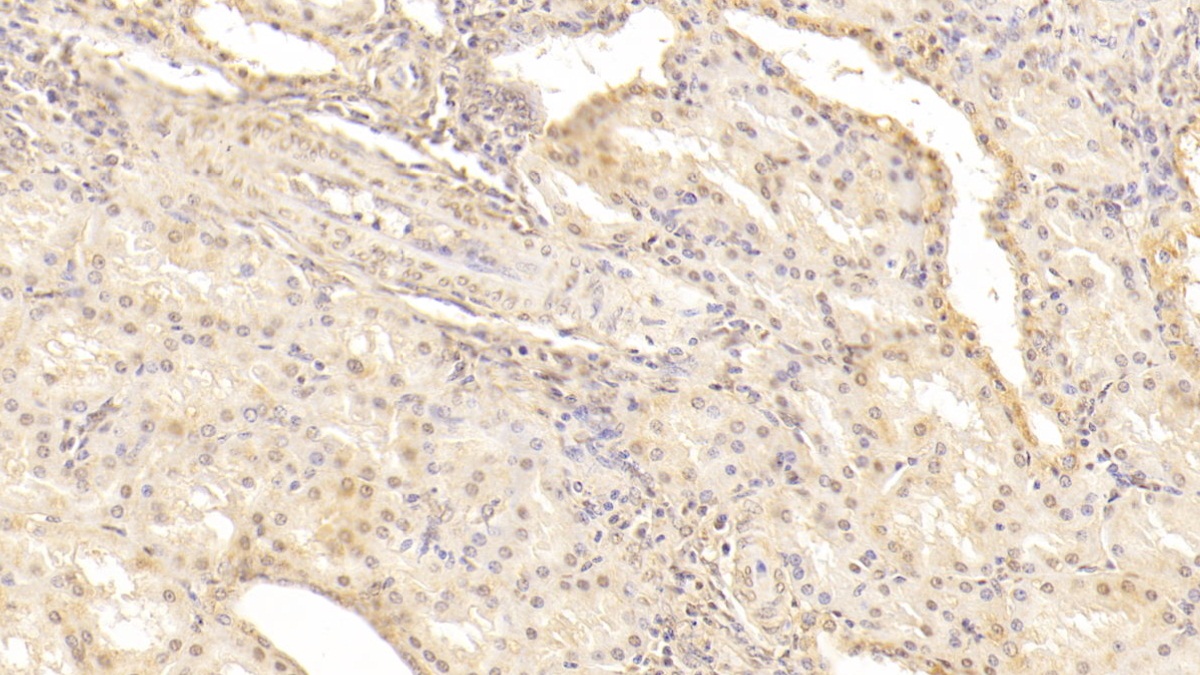 Monoclonal Antibody to Apolipoprotein A1 (APOA1)