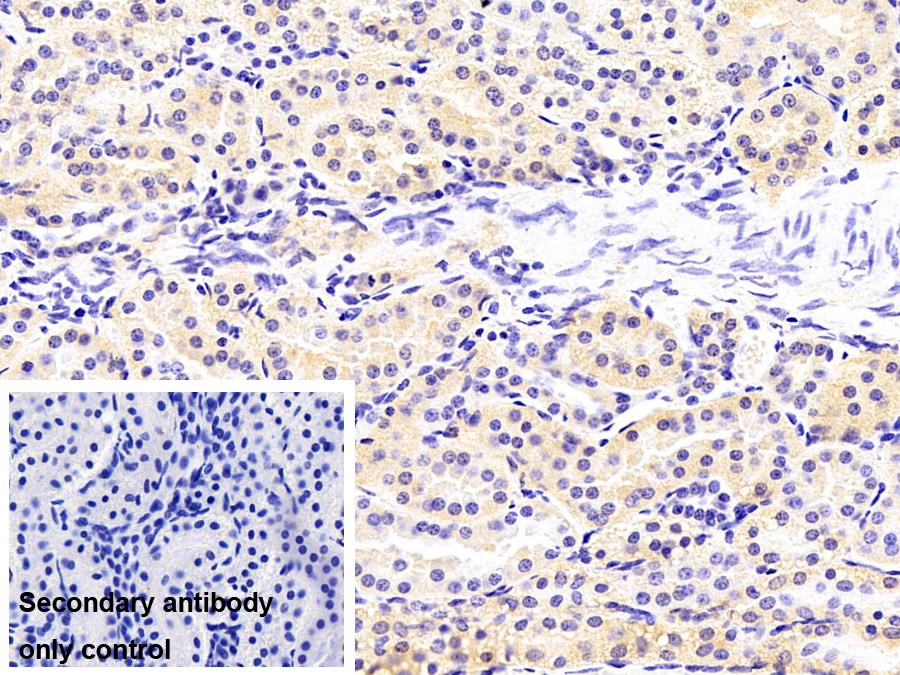 Monoclonal Antibody to Protein Kinase R (PKR)