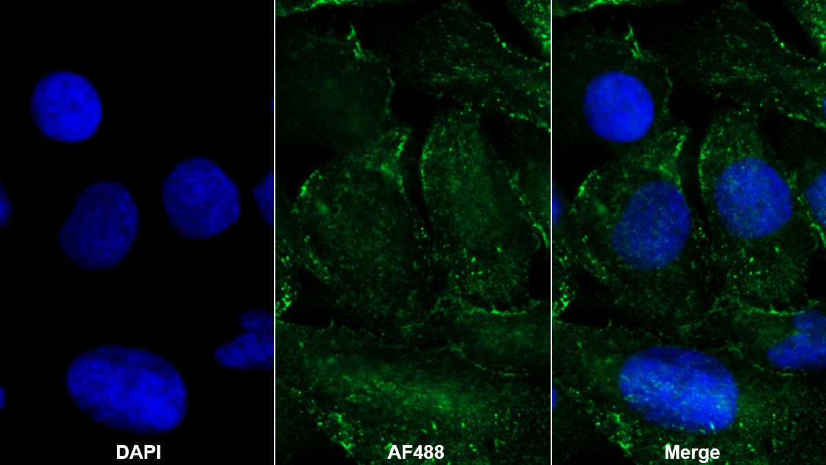 Monoclonal Antibody to Platelet Derived Growth Factor AA (PDGFAA)