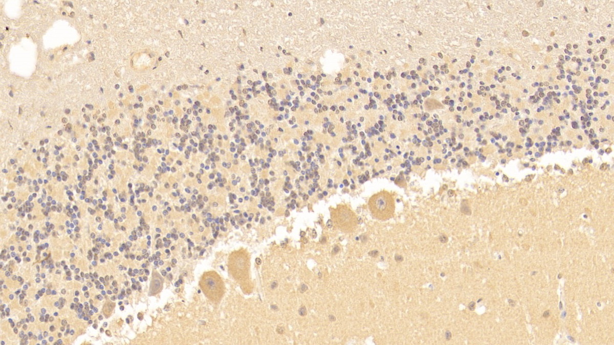 Monoclonal Antibody to Tissue Factor (TF)