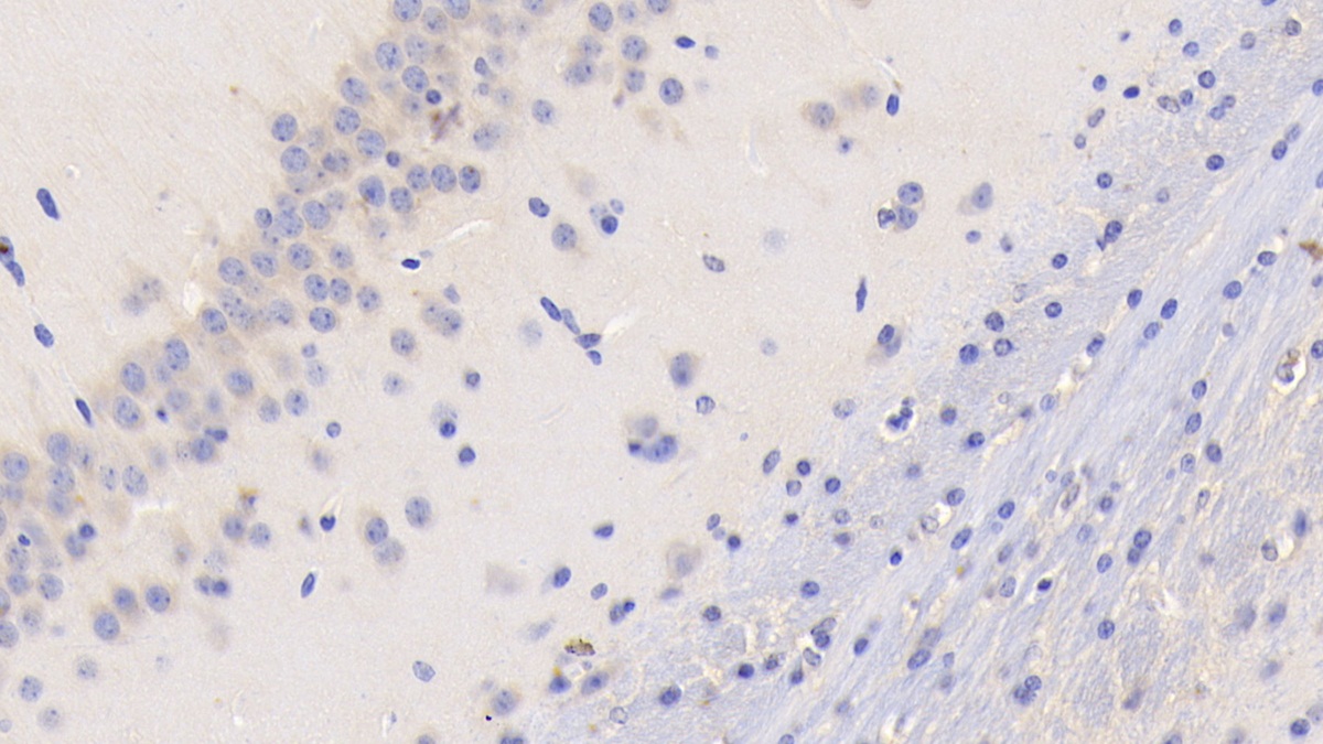 Monoclonal Antibody to Tissue Factor (TF)