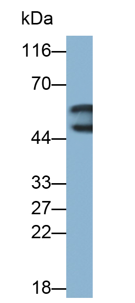 Monoclonal Antibody to Tissue Factor (TF)