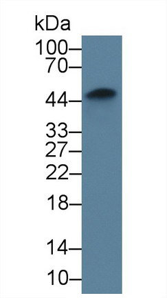 Monoclonal Antibody to Tissue Factor (TF)