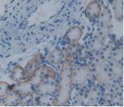 Monoclonal Antibody to Plasminogen Activator Inhibitor 2 (PAI2)