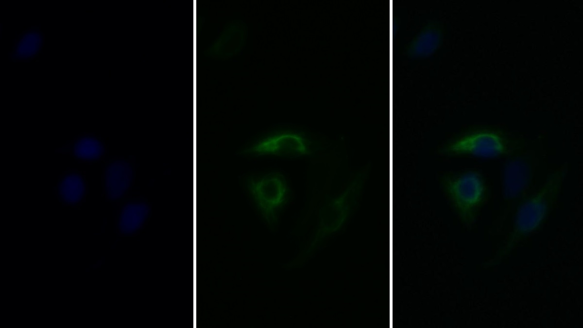 Monoclonal Antibody to Plasminogen Activator Inhibitor 1 (PAI1)