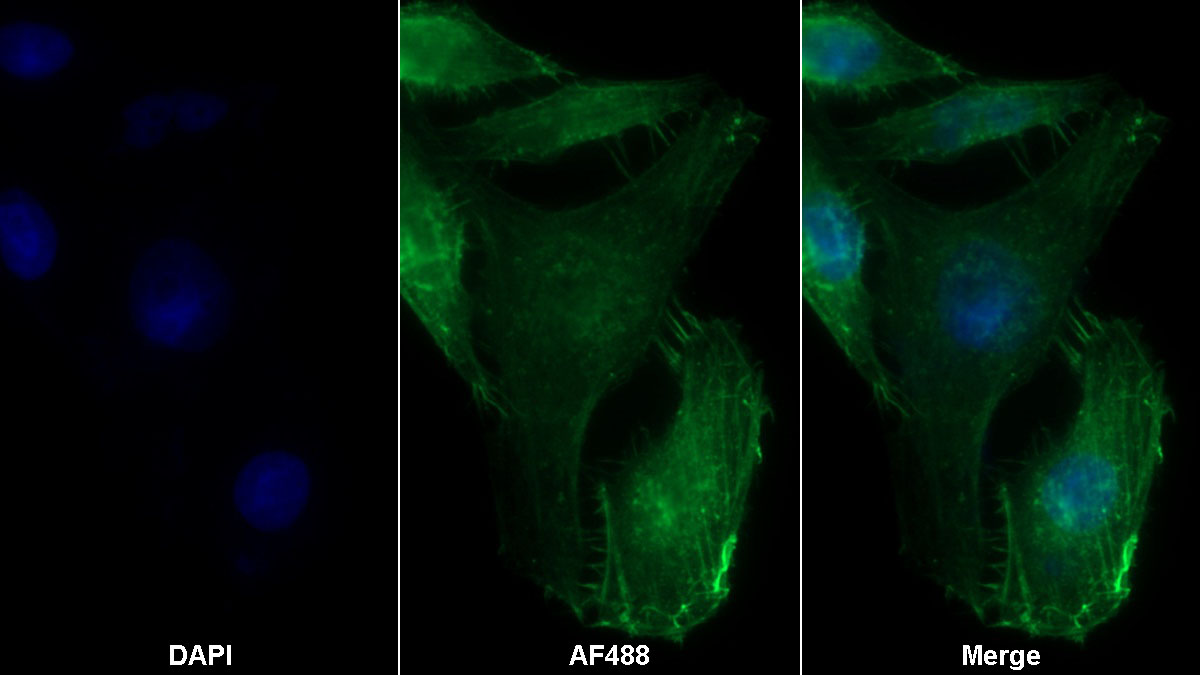 Monoclonal Antibody to Plasminogen Activator Inhibitor 1 (PAI1)