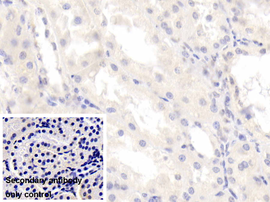 Monoclonal Antibody to Plasminogen Activator Inhibitor 1 (PAI1)