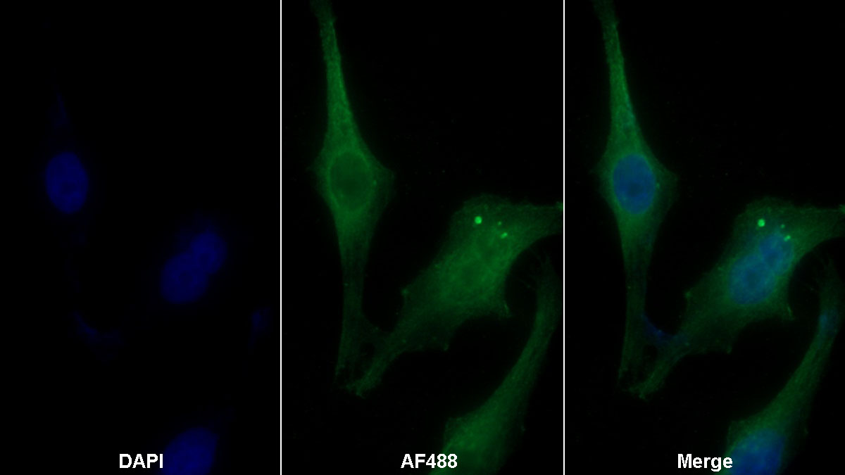 Monoclonal Antibody to Plasminogen Activator Inhibitor 1 (PAI1)