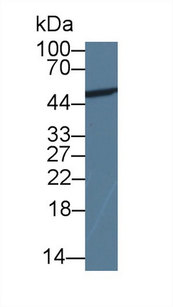 Monoclonal Antibody to Enolase, Neuron Specific (NSE)