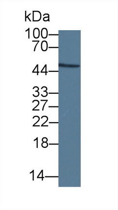 Monoclonal Antibody to Enolase, Neuron Specific (NSE)