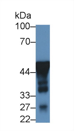 Monoclonal Antibody to Enolase, Neuron Specific (NSE)