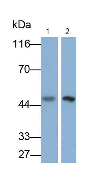 Monoclonal Antibody to Enolase, Neuron Specific (NSE)