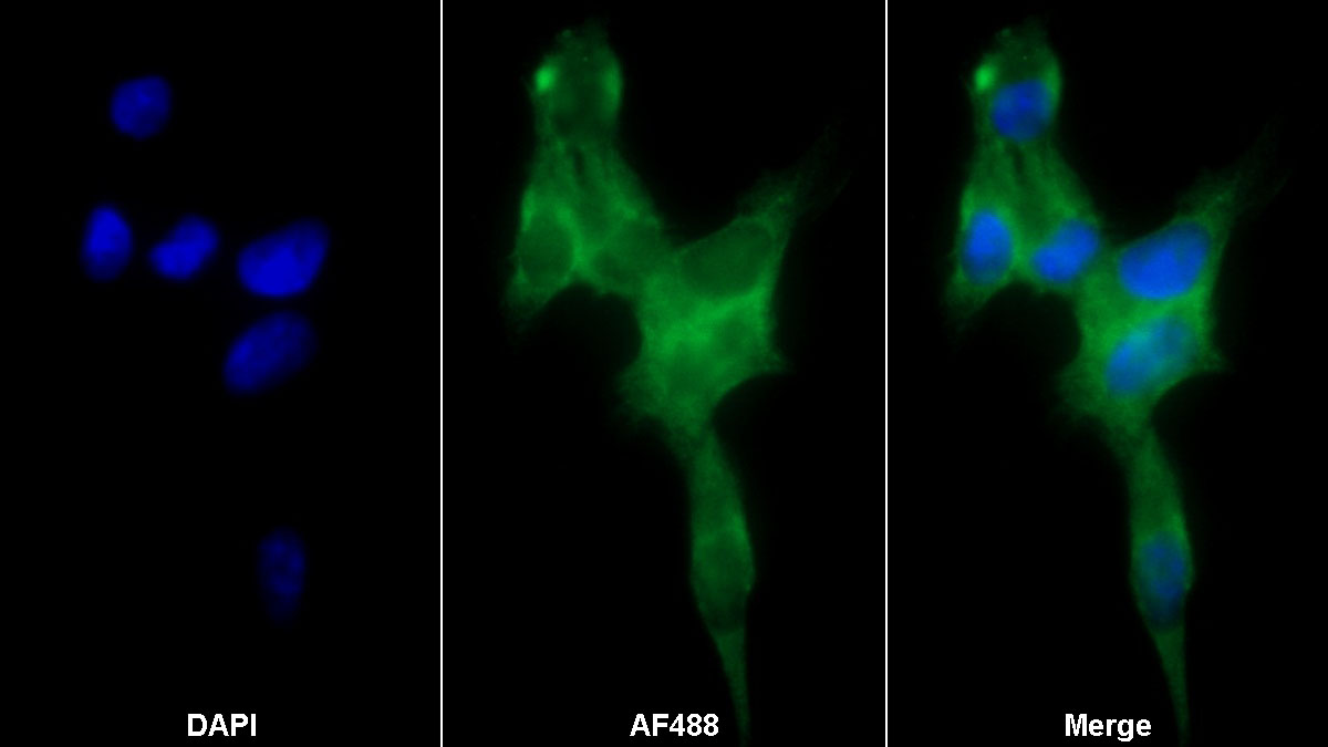 Monoclonal Antibody to Enolase, Neuron Specific (NSE)