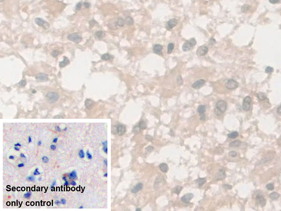 Monoclonal Antibody to Enolase, Neuron Specific (NSE)