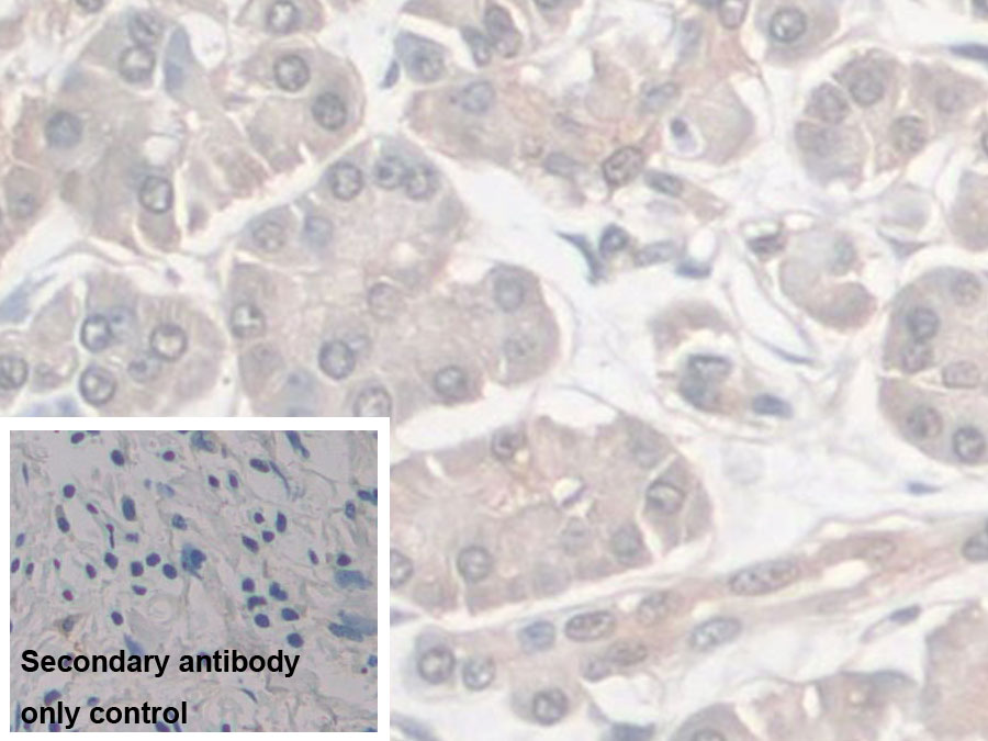 Monoclonal Antibody to Enolase, Neuron Specific (NSE)