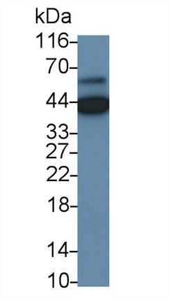 Monoclonal Antibody to Myelin Basic Protein (MBP)