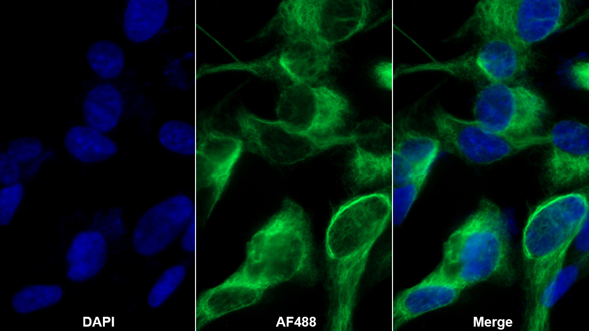 Monoclonal Antibody to Myelin Basic Protein (MBP)