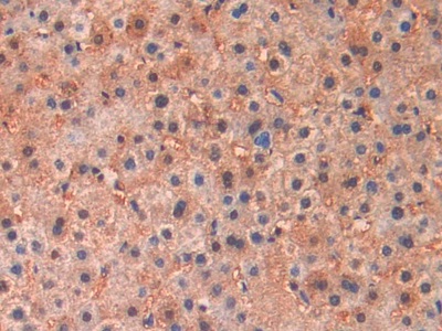 Monoclonal Antibody to Brain Natriuretic Peptide (BNP)